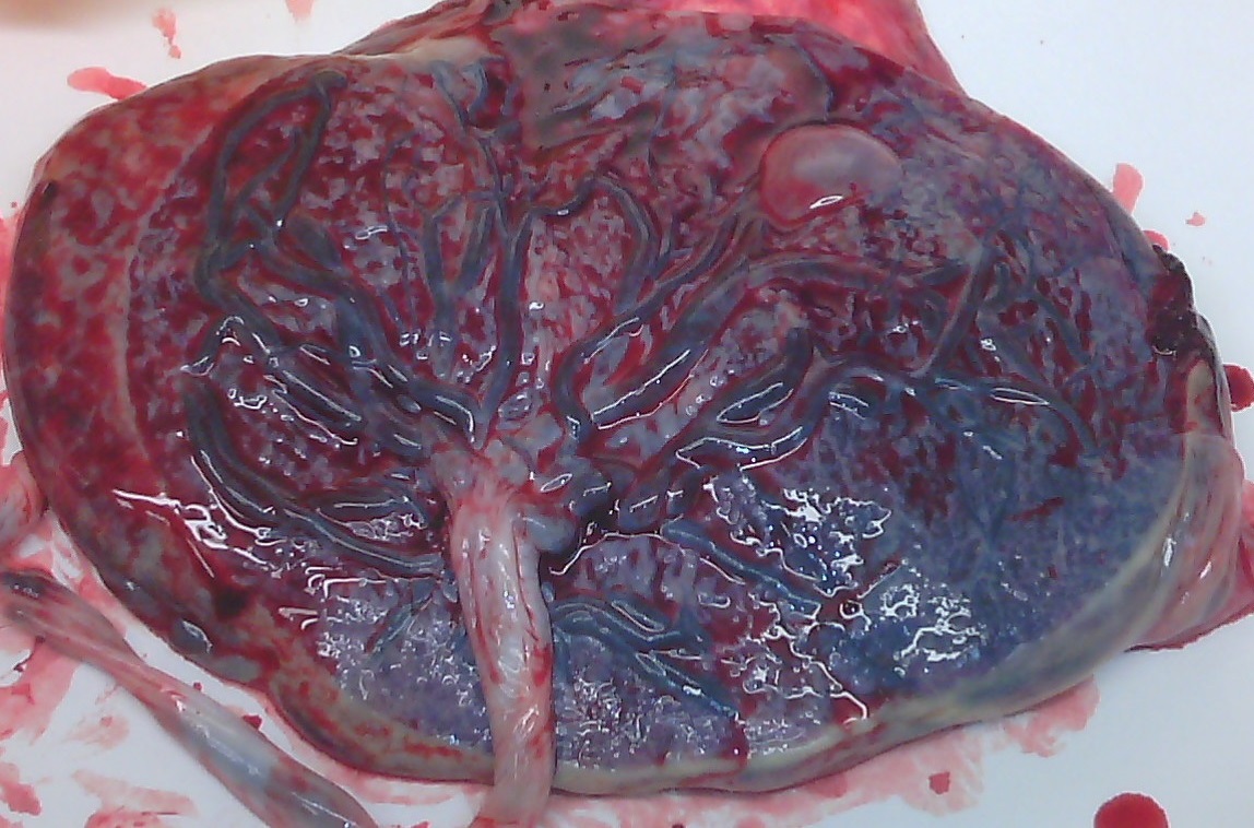 By Aidar.seralin - Own work, CC BY-SA 4.0