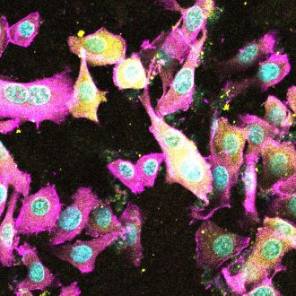Epithelial cells_affected by EspC toxin