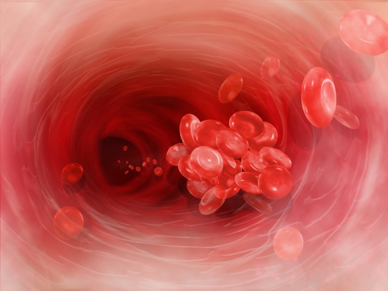 Credit: Blood clot image, Kan Goagülasyon, Wikimedia Commons: https://commons.wikimedia.org/wiki/File:Blood-clot1.jpg