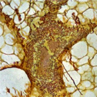 Unstained healthy non-cancerous tissue viewed using a NanoMslide