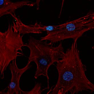 Stem cells becoming bone cells (2)