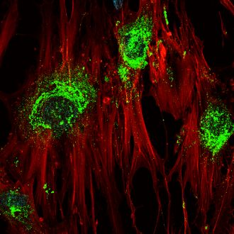 Stem cells becoming bone cells 