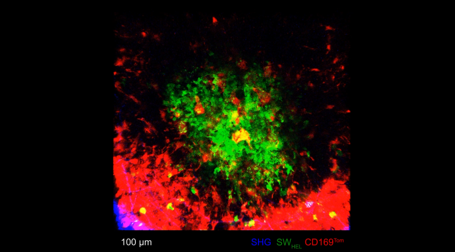 2-Photon microscope image of the germinal centre inside a lymph node, showing B cells (green) moving around and tingible body macrophages (red) evenly dispersed to grab the dead and dying cells. Credit: Garvan