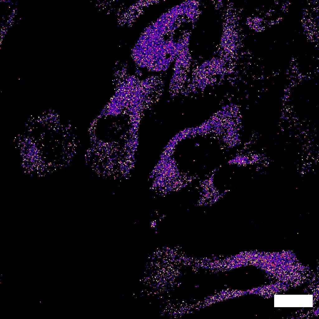 Cells in an acidic environment, as demonstrated by the nanobiosensor.
