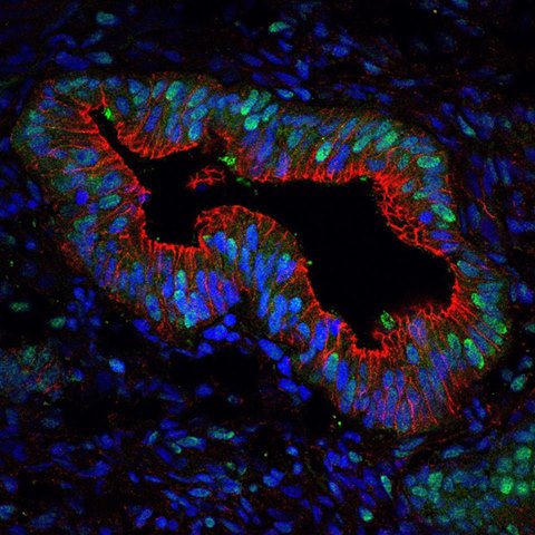 Endometrial stem cells