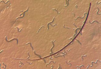 A population of C. elegans with an author’s eyelash for scale