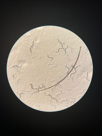 A population of C. elegans with an author’s eyelash for scale