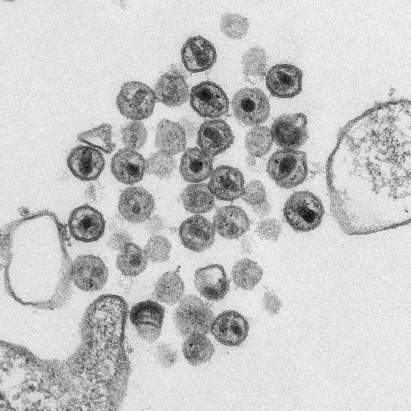 Transmission electron microscopy image of HIV particles; CDC Public Health Image Library