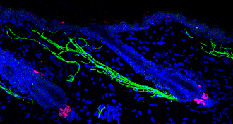 Stem cells