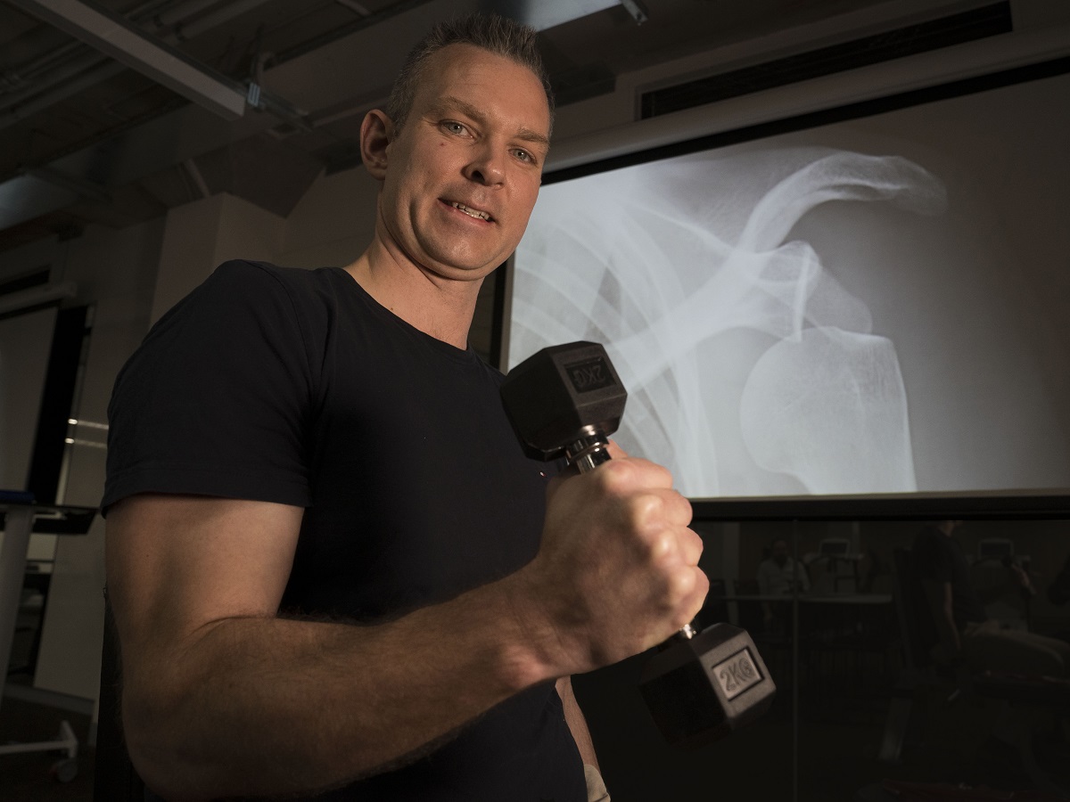Dr Timothy Lathlean’s research shows patients with dislocated shoulders can benefit from a robust exercise program soon after surgery.
