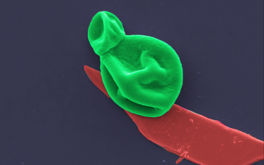 A fungal cell (green) interacting with a nanothin layer of black phosphorous (red). Image magnified 25,000 times. 