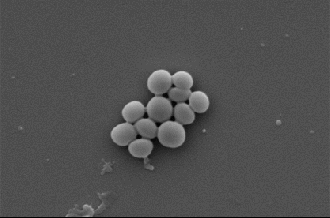 MRSA before and after treatment (gif)