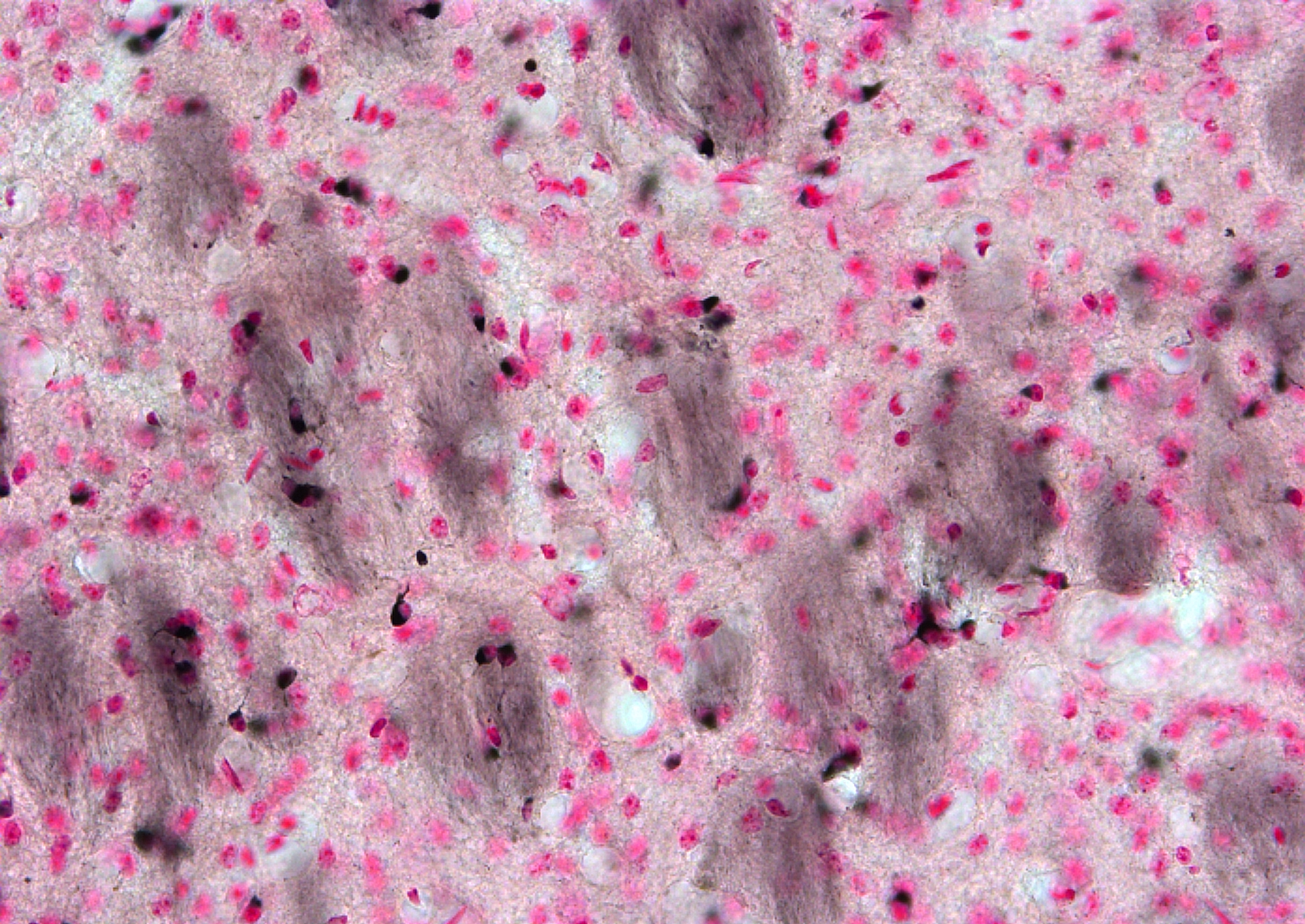 Florey Institute of Neuroscience and Mental Health