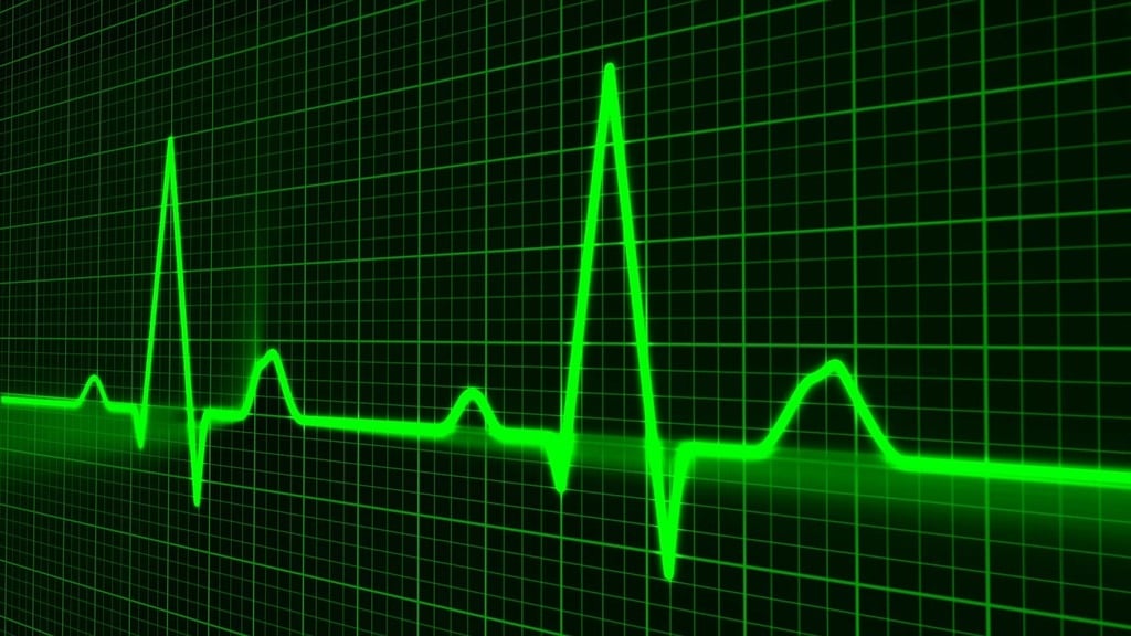 CC-0. https://garystockbridge617.getarchive.net/amp/media/pulse-trace-healthcare-medicine-heartbeat-6fc6b5