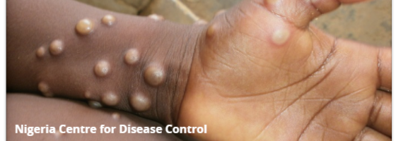 Nigeria Centre for Disease Control