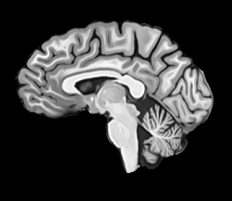 Neuroanatomical changes unfolding throughout gestation