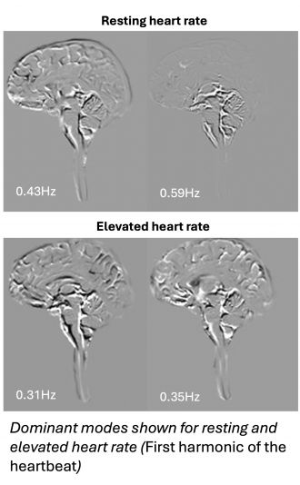 Resting and elevated heartbeat