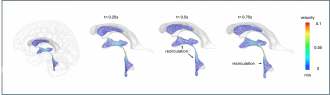 Seeing brain fluid in motion