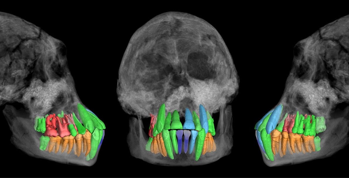 Credit: Vincent Beyrand and Paul Tafforeau, European Synchrotron Radiation Facility, Grenoble, France