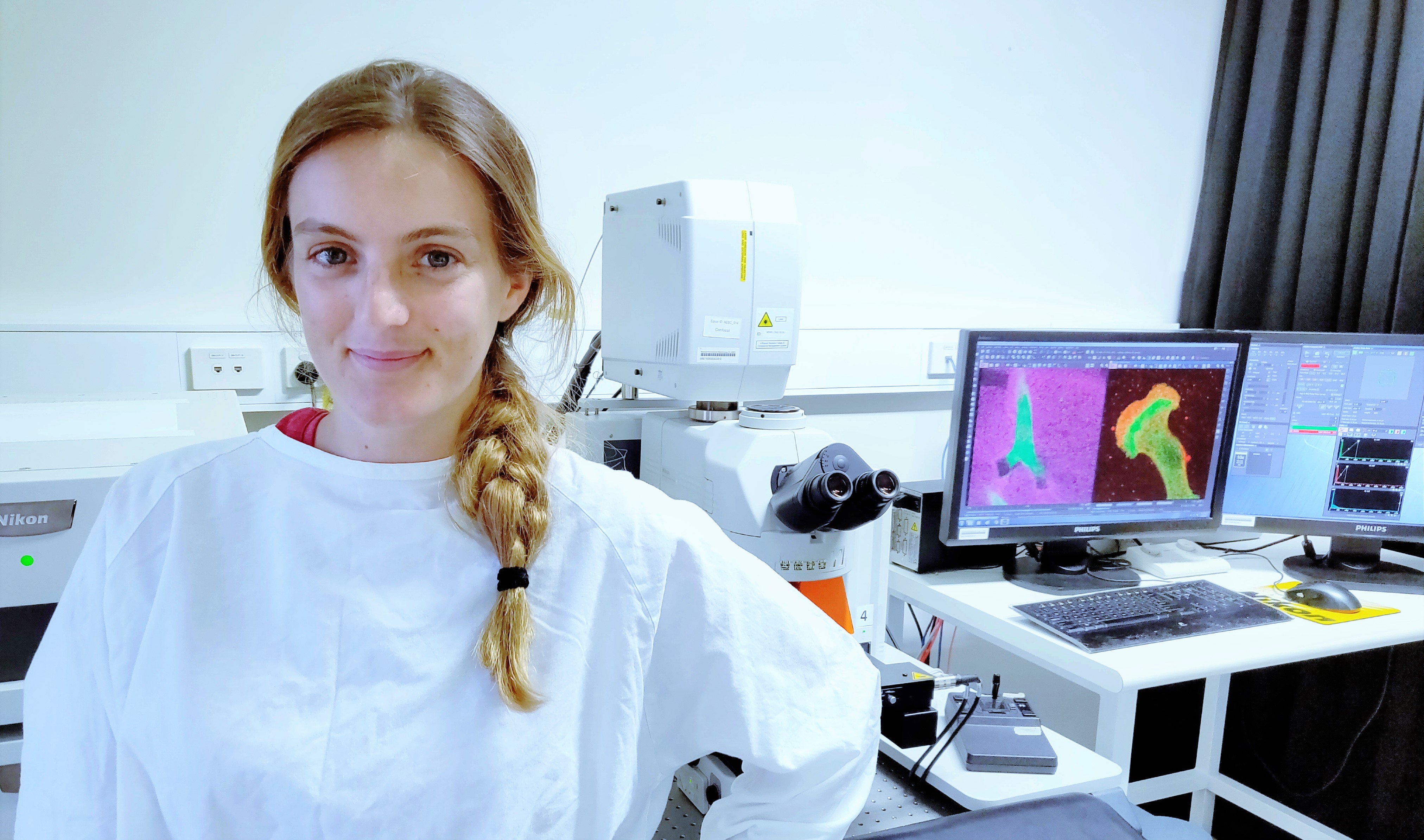 This is the first time scientists have been able to see in detail what the anchor’s chain looks like. Photo: Marco Heydecker.