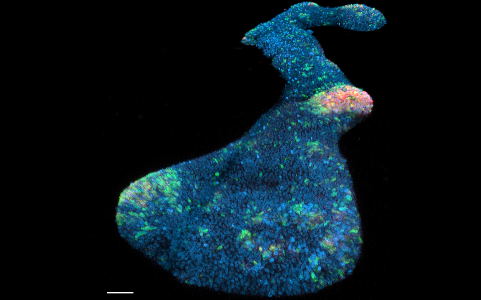 Spinal cord organoids created by University of Queensland researchers could help enable women with epilepsy safer access to a common and highly effective anti-seizure medication. 