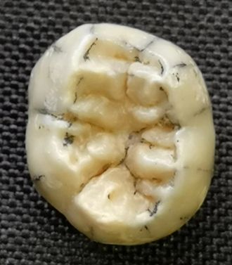 Ngu Hao 2 tooth