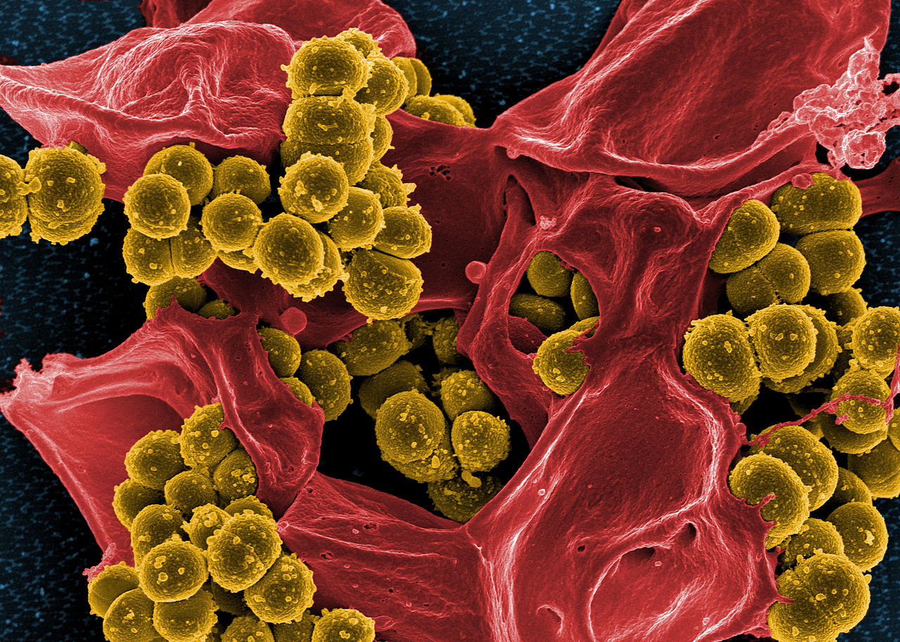 Scanning_electron_micrograph_of_Methicillin-resistant_Staphylococcus_aureus_(MRSA)_and_a_dead_Human_neutrophil By NIAID_Flickr CC BY 2_0 Scanning_electron_micrograph_of_Methicillin-resistant_Staphylococcus_aureus_(MRSA)_and_a_dead_Human_neutrophil By NIAID_Flickr CC BY 2_0
