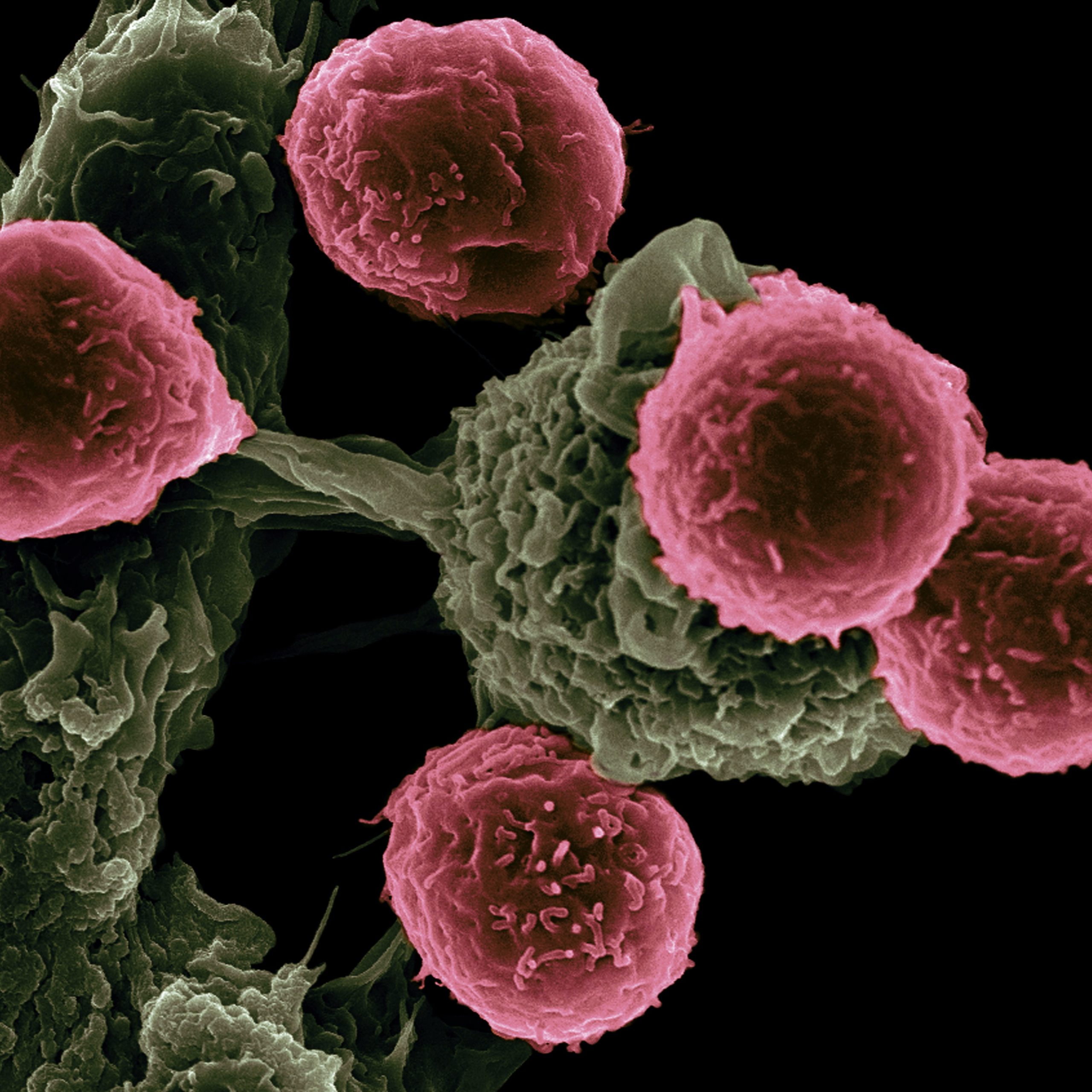Cancer cells