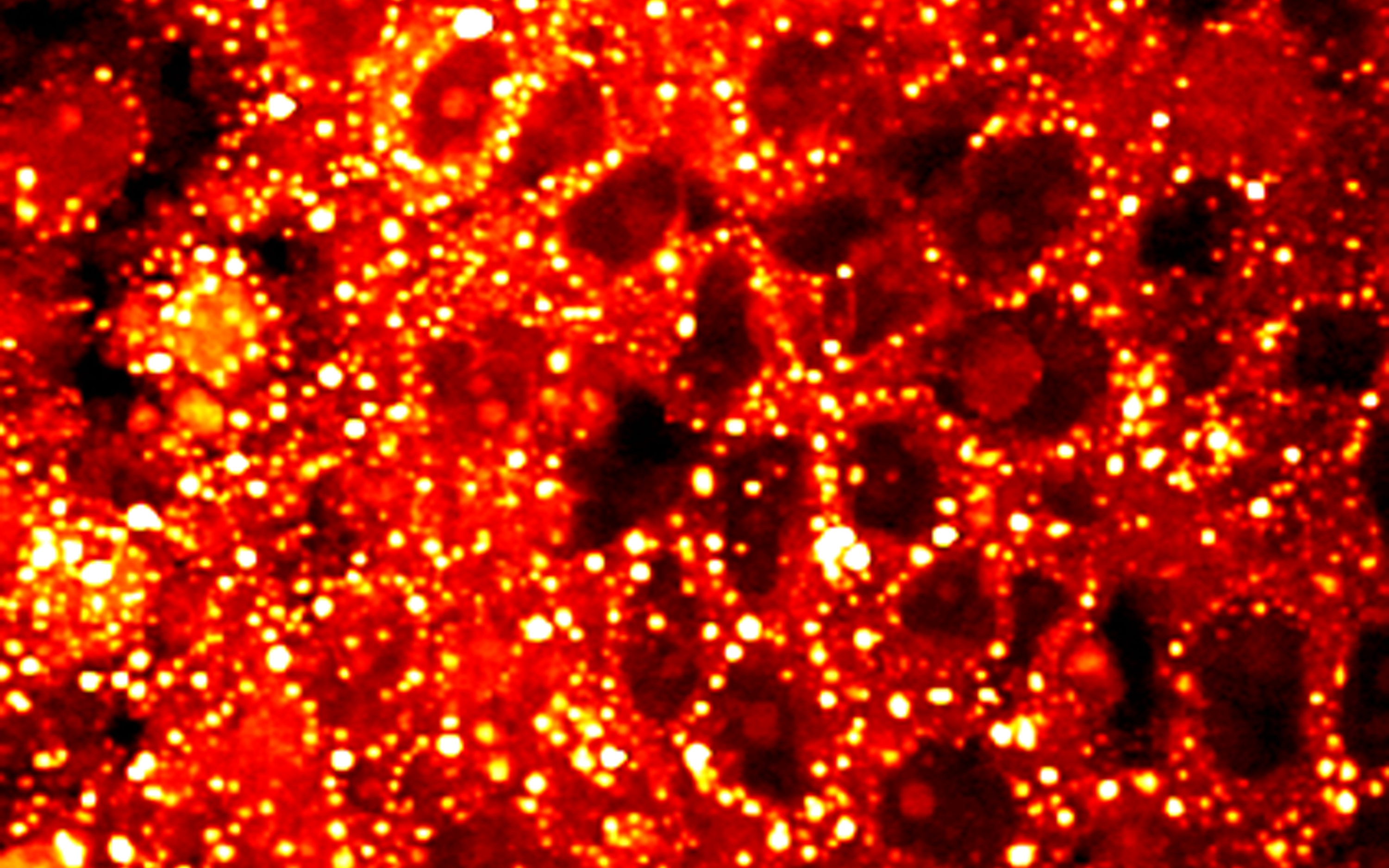 Abnormal lipid metabolism in prostate cancer. Credit: Ji-Xin Cheng, National Cancer Institute / Purdue University Center for Cancer Research