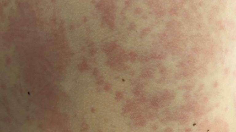 Creative Commons CC0 1.0 Universal Public Domain Dedication.