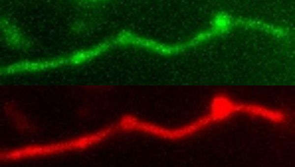 Queensland Brain Institute - Shanley Longfield 