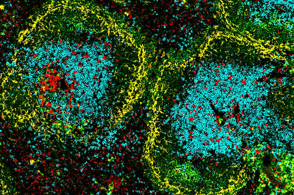 DC-SCRIPT positive cells (red) activating an immune response (blue T cells). Credit: Shengbo Zhang and Wang Cao, WEHI