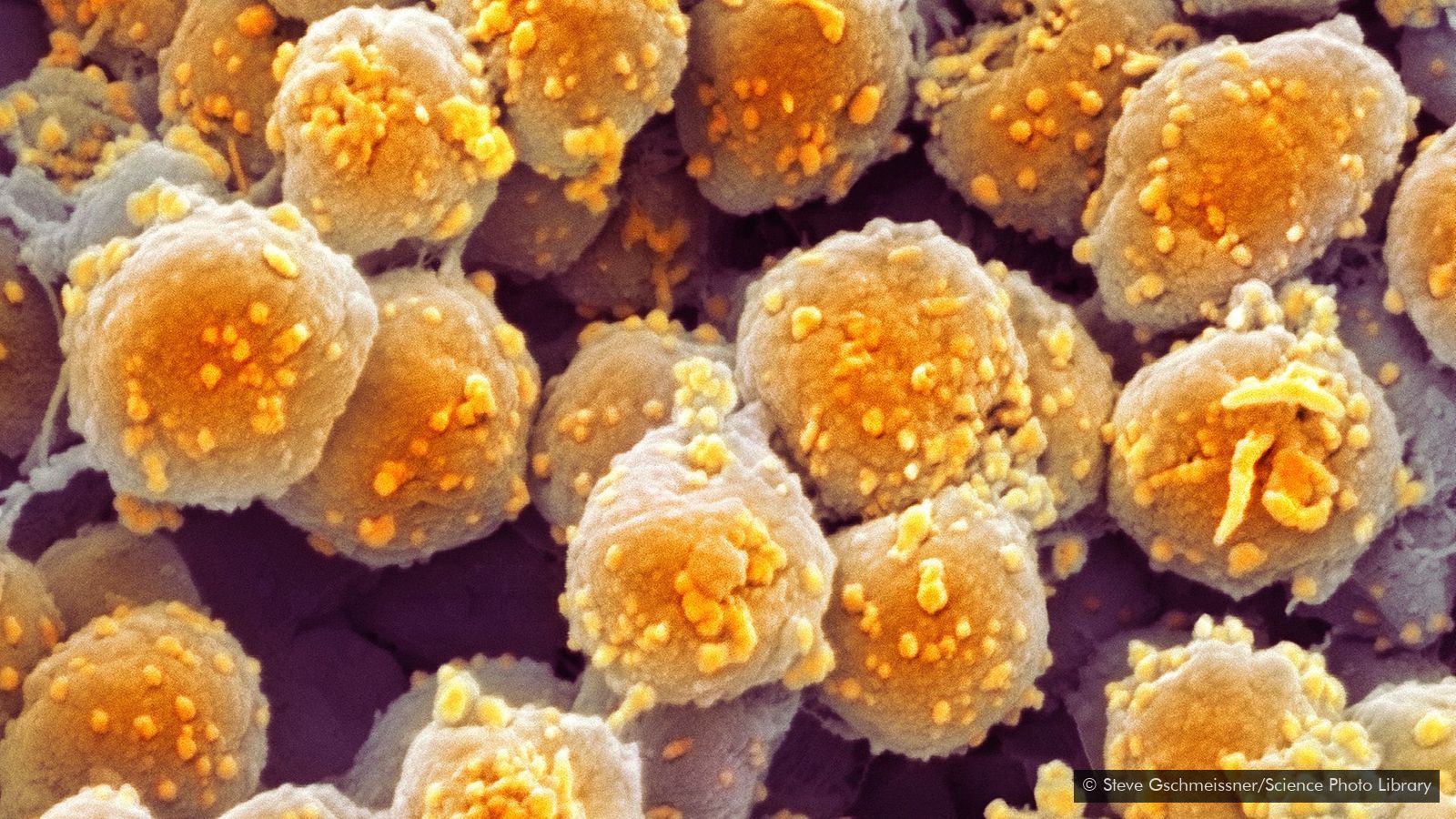 Image of archaea (Credit: Steve Gschmeissner/Science Photo Library)