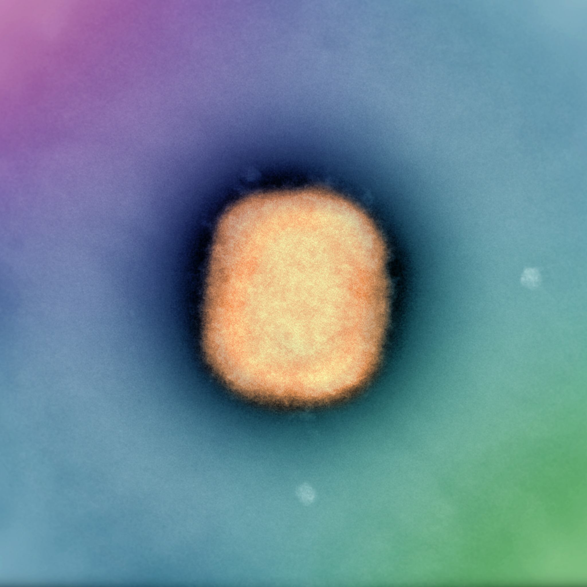False coloured electron micrograph of a single negative-stained Monkeypox virus particle. Negative contrast transmission electron microscopy using 2% phosphotungstic acid, 52,000x magnification. Image credit: Dr Jason Roberts, Head of the Electron Microscopy and Structural Virology Laboratory at the Doherty Institute