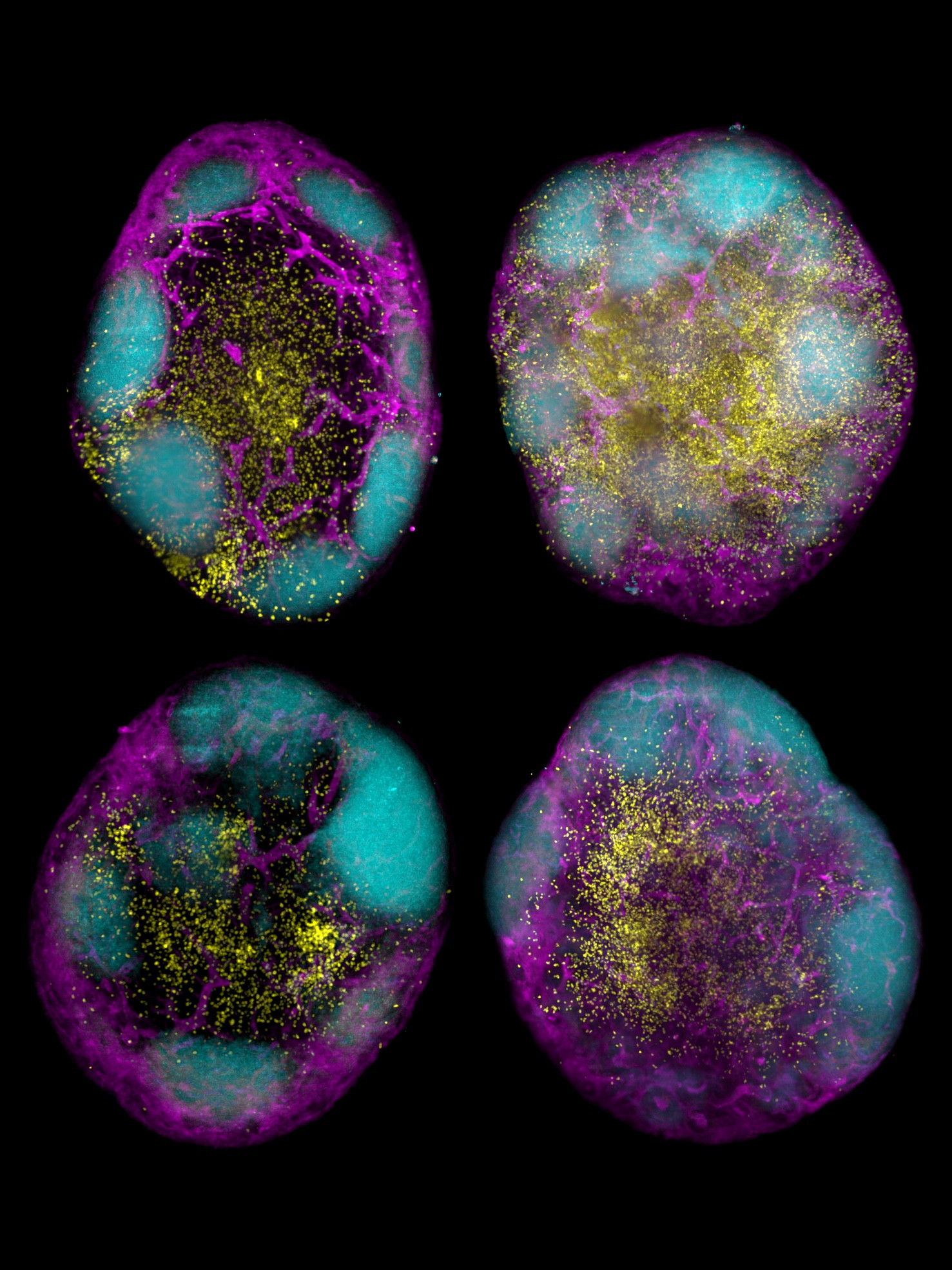 CD8+ T cells (yellow) inside mouse lymph nodes. Scientists developed a strategy to boost these cells using mRNA vaccine technology. Credit: WEHI