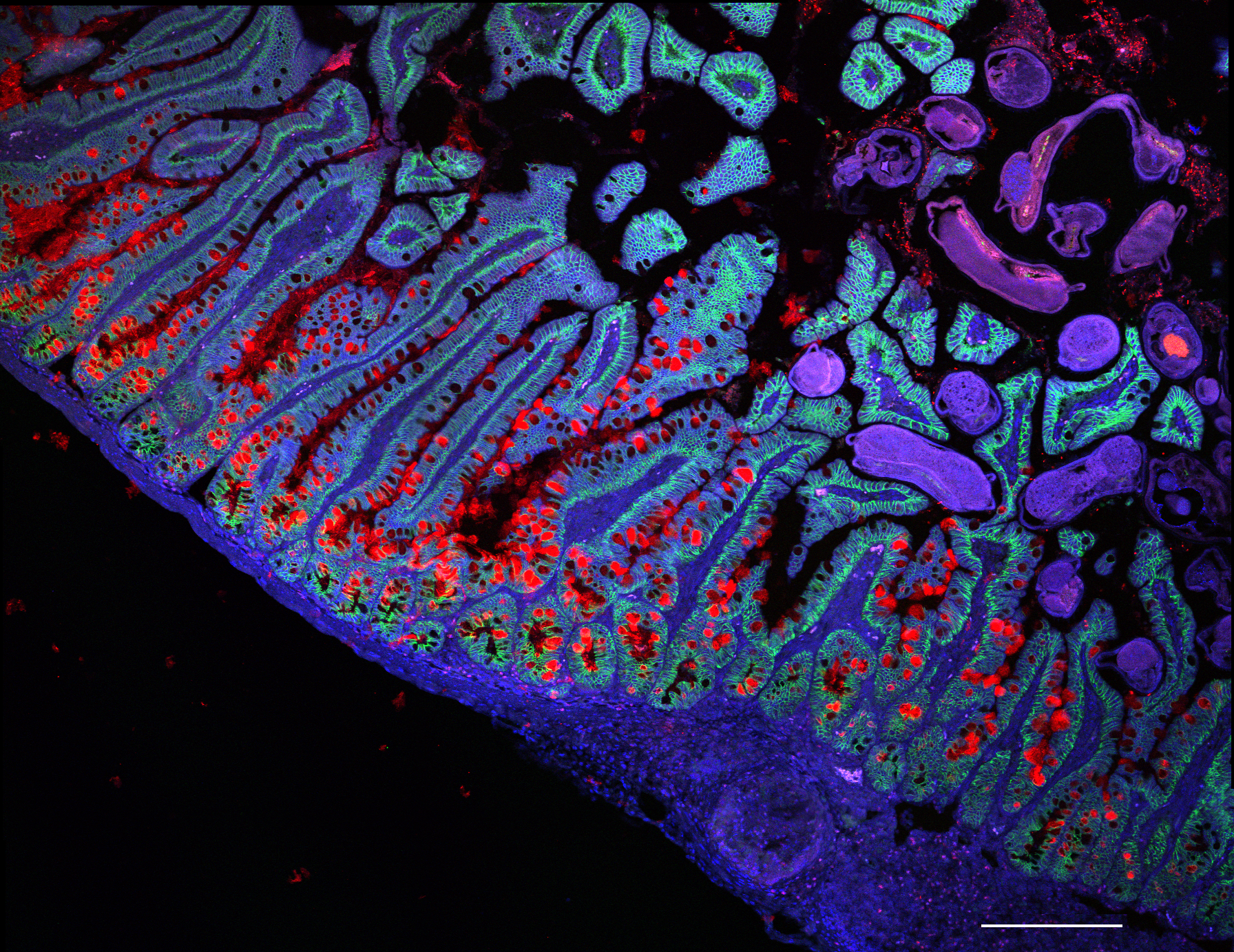 Grace Burgin, Noga Rogel & Moshe Biton, Klarman Cell Observatory, Broad Institute