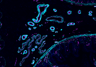 Blood vessels in a human ileum sample