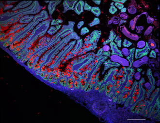The human small intestine.