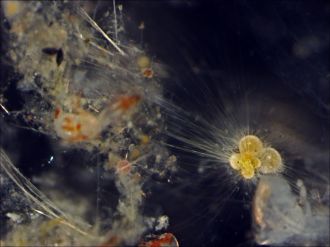 Planktonic foraminifera (bottom right) surrounded by thin strands cytoplasm
