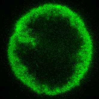 Nanoscale 3D scan of protein condensate s