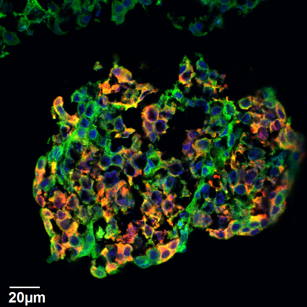 A human Pancreatic Islet. Green represents CD47 and red represents Insulin. Blue (DAPI) represents nuclei.