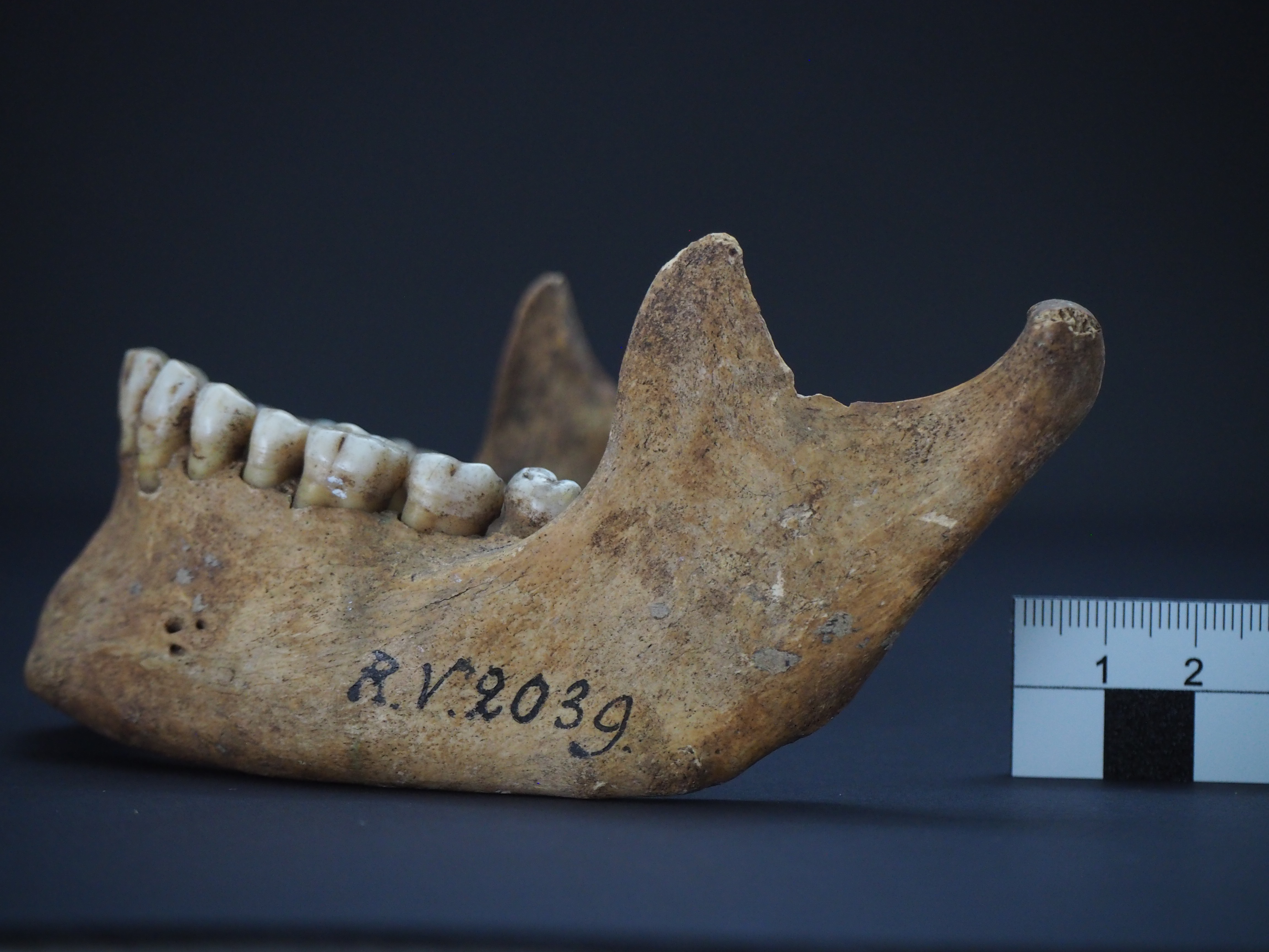 Jawbone of the man who was buried in Riņņukalns, Latvia, around 5000 years ago CREDIT Dominik Göldner, BGAEU, Berlin